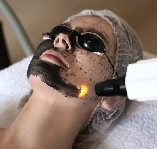 Hollywood Peel con Limpieza