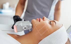 HIFU Facial